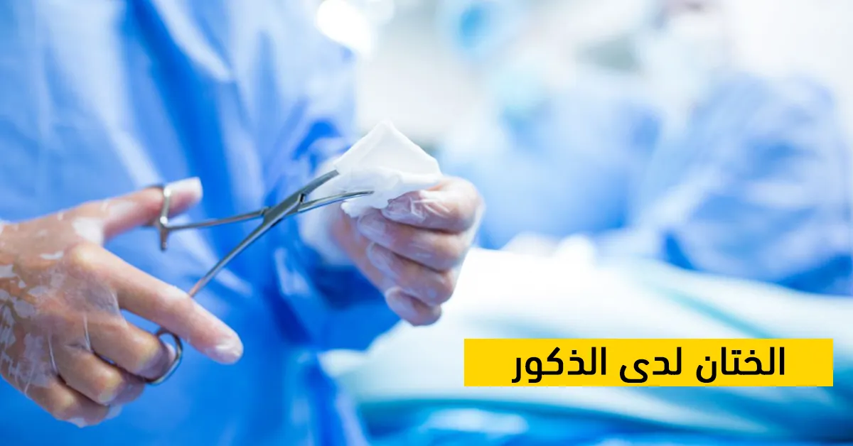 الختان لدى الذكور